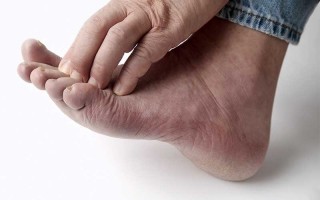 Foot Arthritis