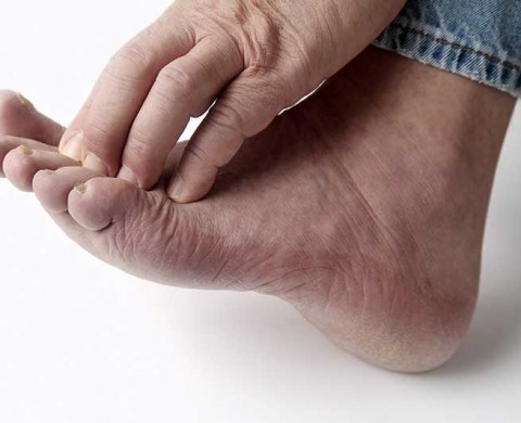 Foot Arthritis